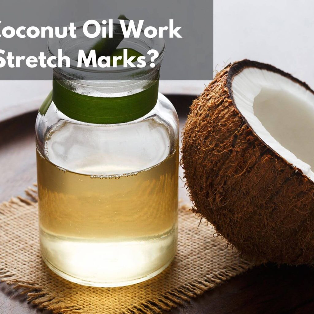 Does Coconut Oil Work For Stretch Marks?