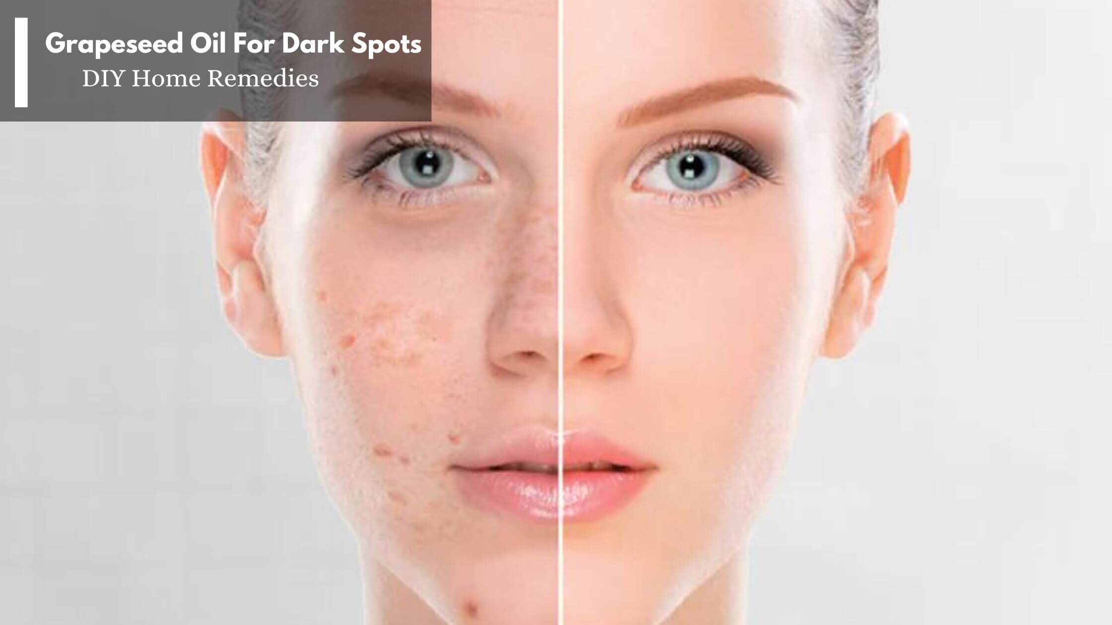 Is Grapeseed Oil A Safe Home Remedy For Facial Dark Spots 