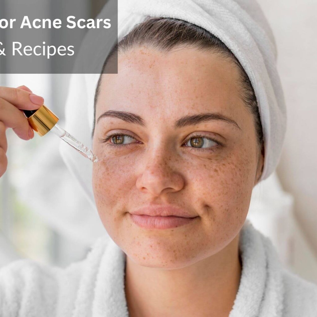 How To Use Jojoba Oil To Treat Acne Scars
