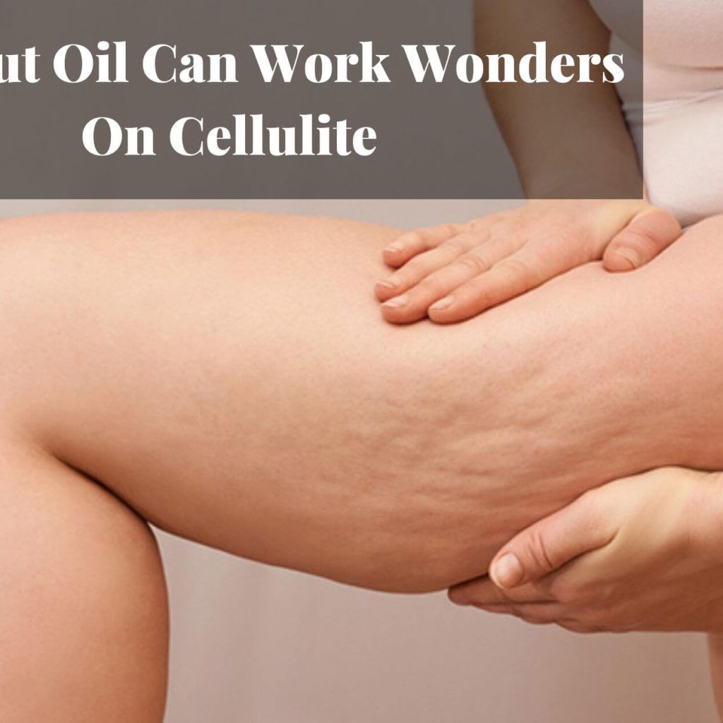 Coconut Oil Can Work Wonders On Cellulite