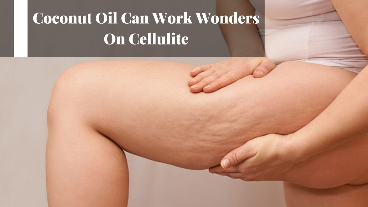 Coconut-Oil-Can-Work-Wonders-On-Cellulite-1