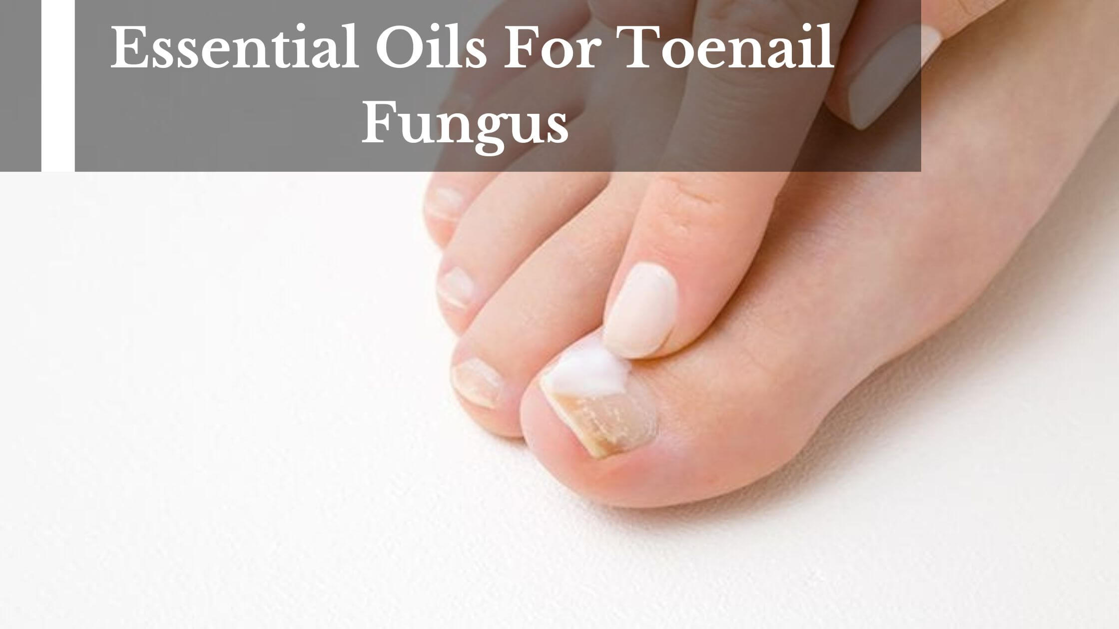 Extra Strong Finger & Toenail Fungus Treatment| Organic & USA Made Nail  Fungus Treat-Ment| Cure Athlete's Foot & Infected Nails with Our Fungus  Treatment| Best Antiseptic Toe Nail Fungus Treatment (Color: Best