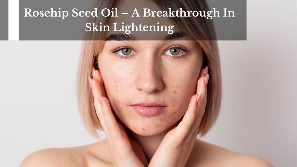Rosehip Seed Oil A Breakthrough In Skin LighteningRosehip Seed Oil