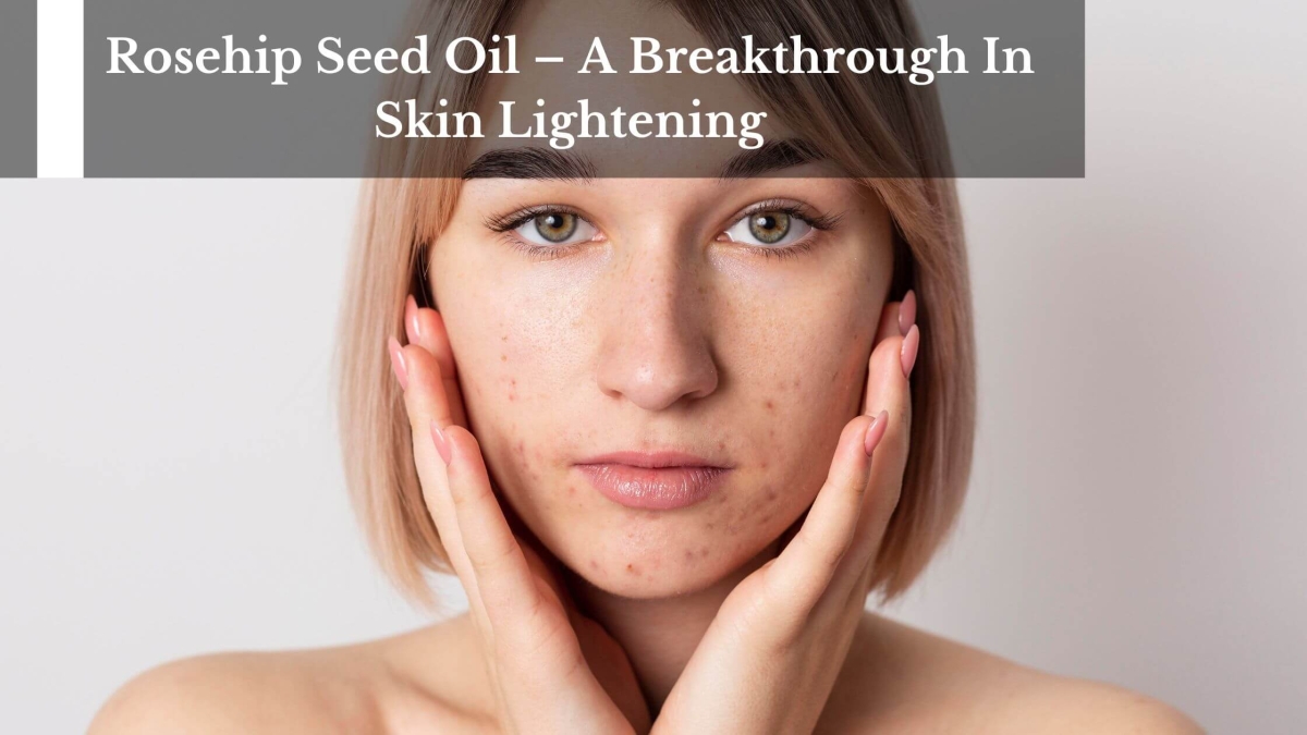 Rosehip-Seed-Oil-–-A-Breakthrough-In-Skin-Lightening-1