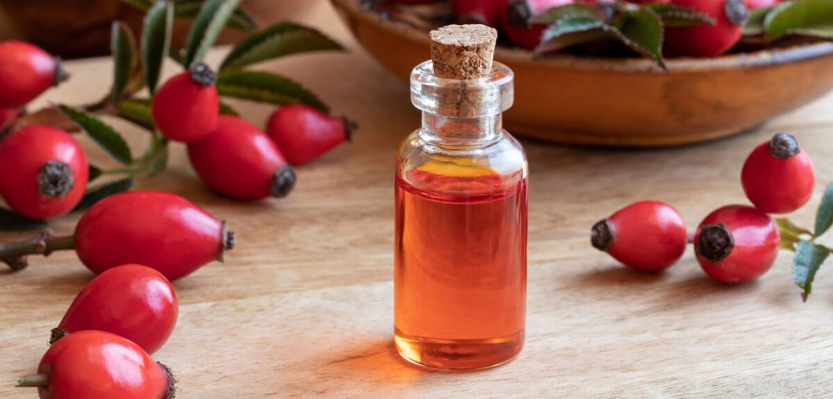 DIYs Recipes Using The Rosehip Seed Oil For Hyperpigmentation