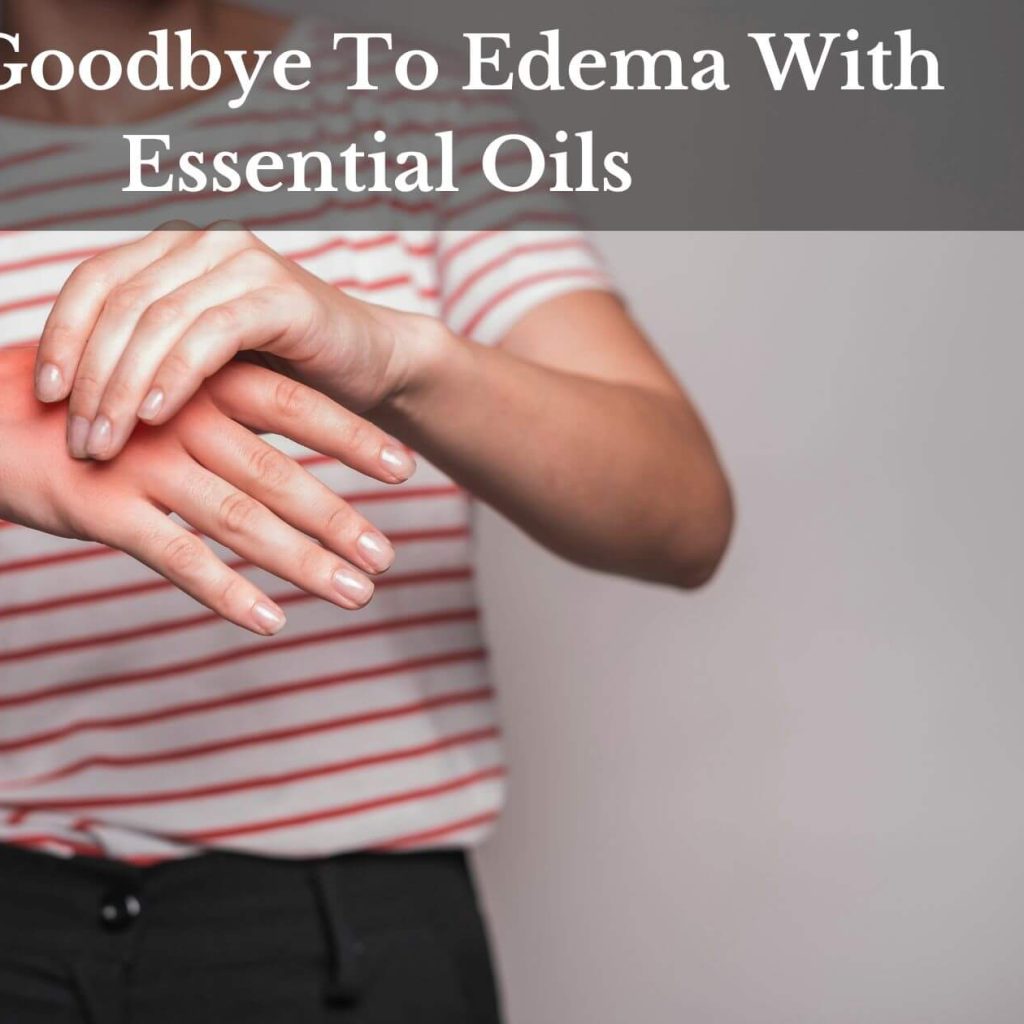 Say Goodbye To Edema With Essential Oils