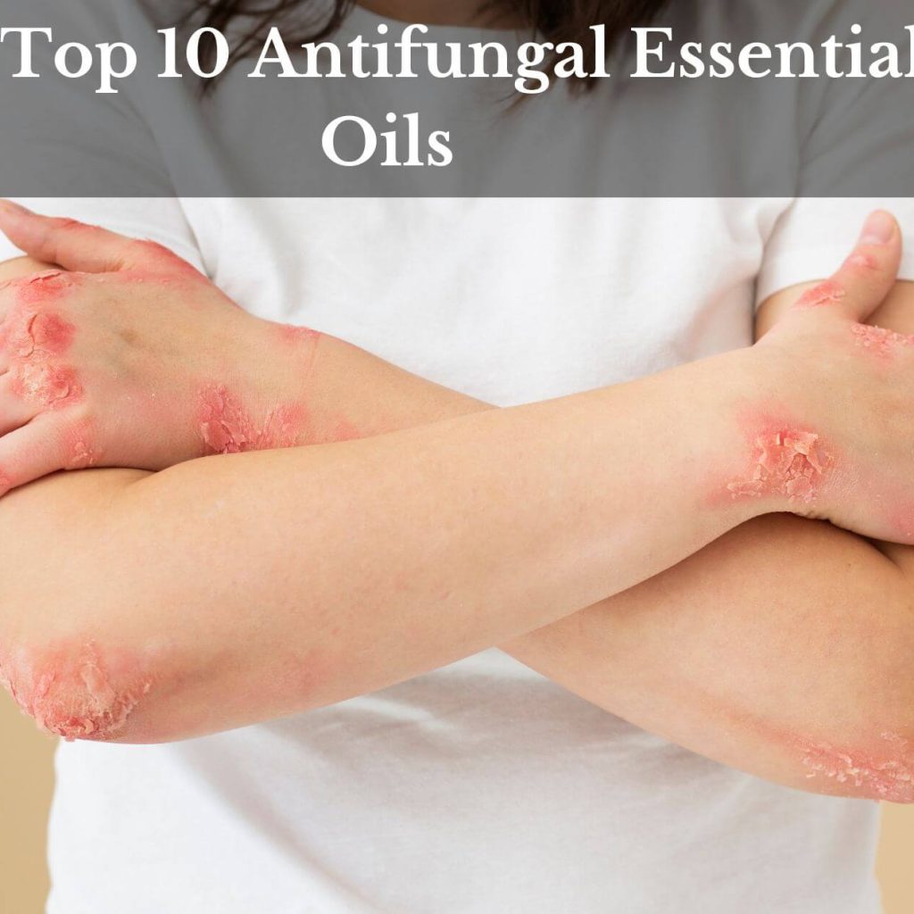 The Top 10 Antifungal Essential Oils