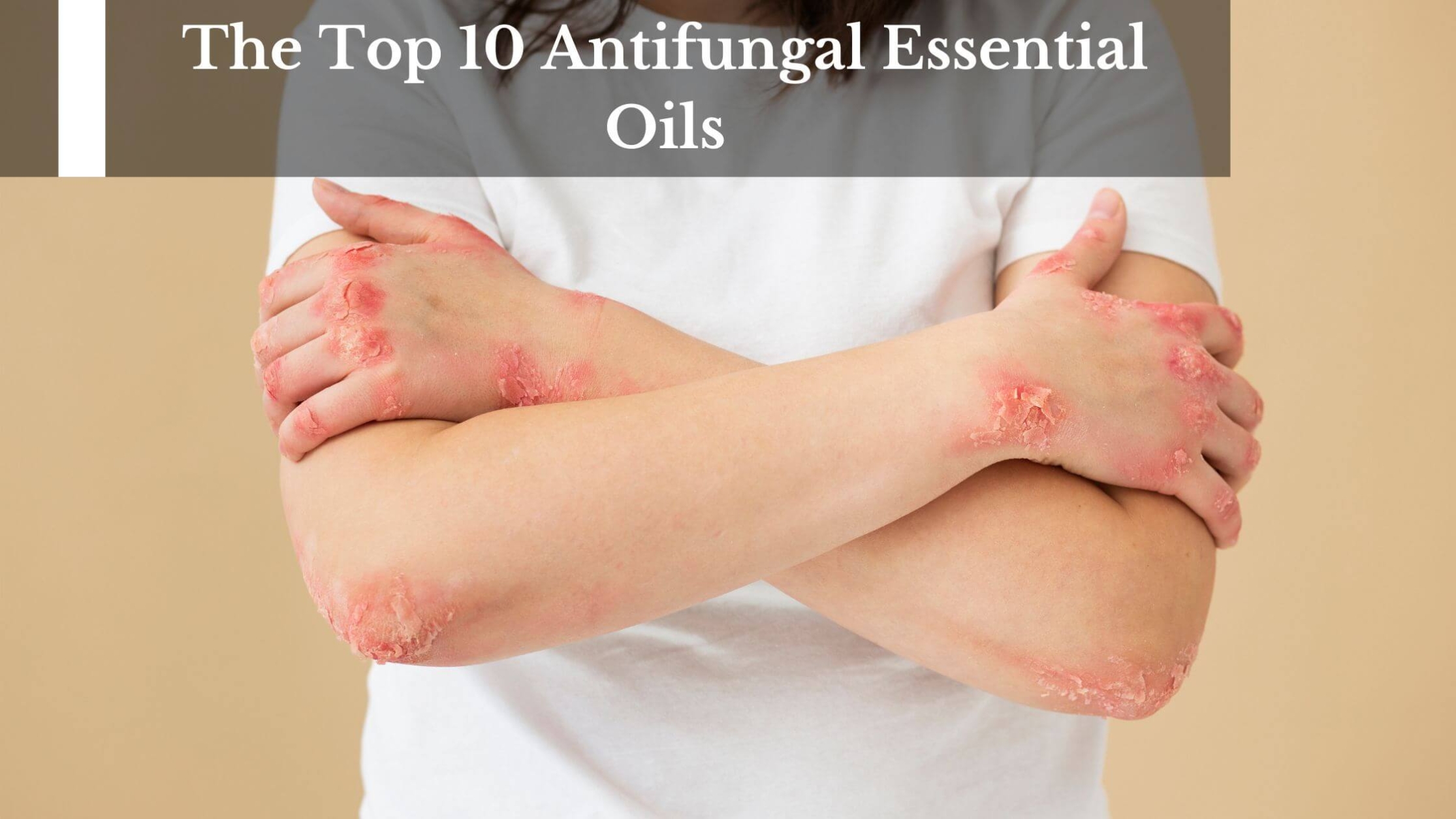 the-top-10-antifungal-essential-oils