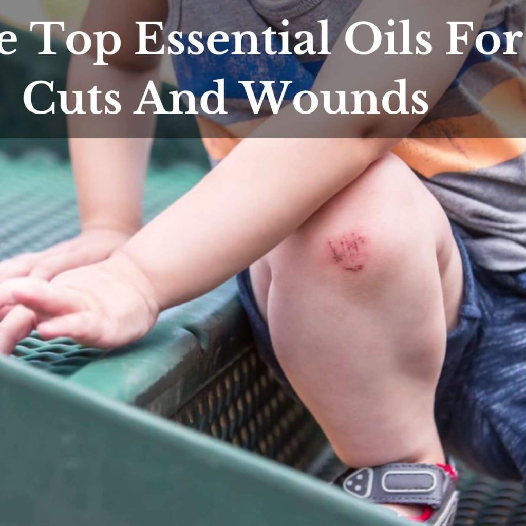 The Top Essential Oils For Cuts And Wounds