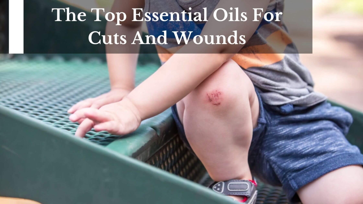 The-Top-Essential-Oils-For-Cuts-And-Wounds-1