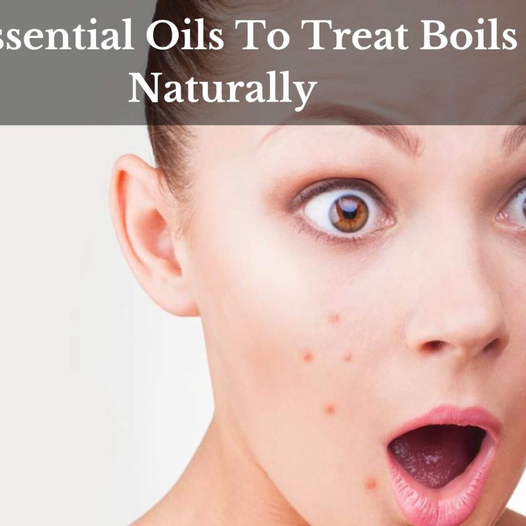 5 Essential Oils To Treat Boils Naturally