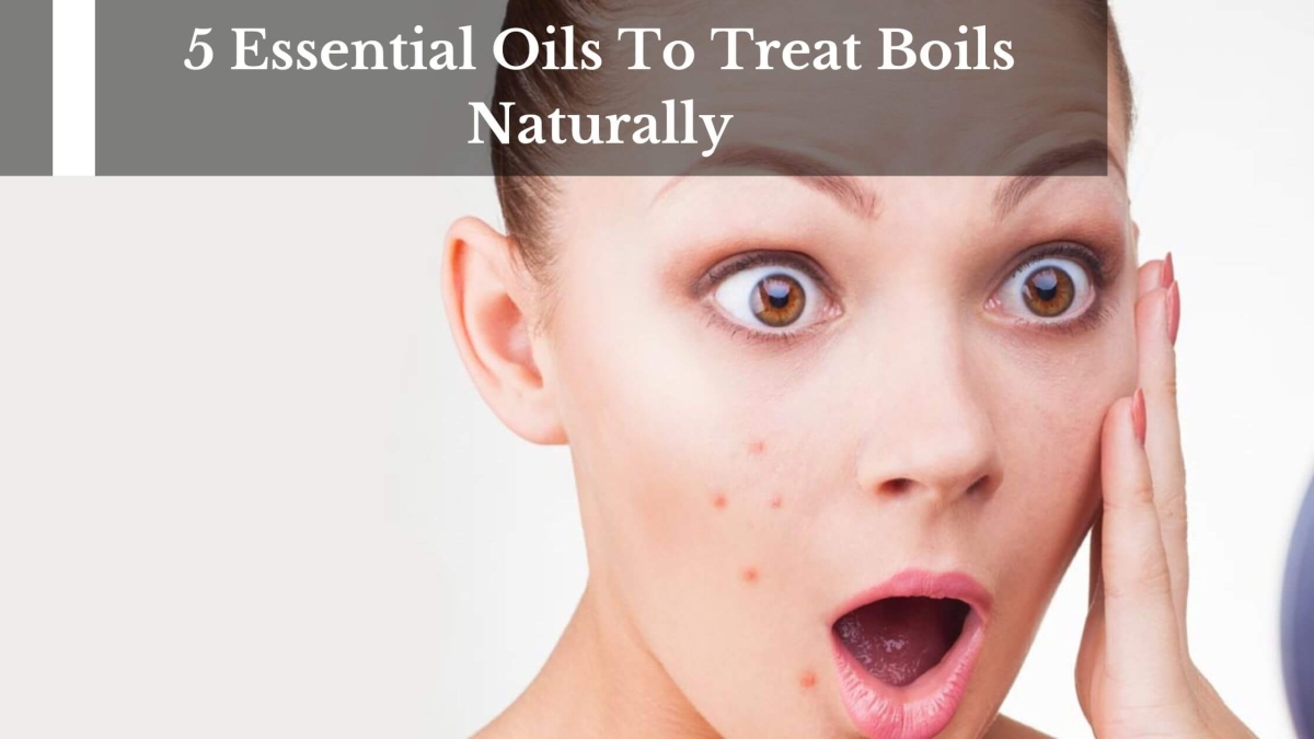 5-Essential-Oils-To-Treat-Boils-Naturally-1
