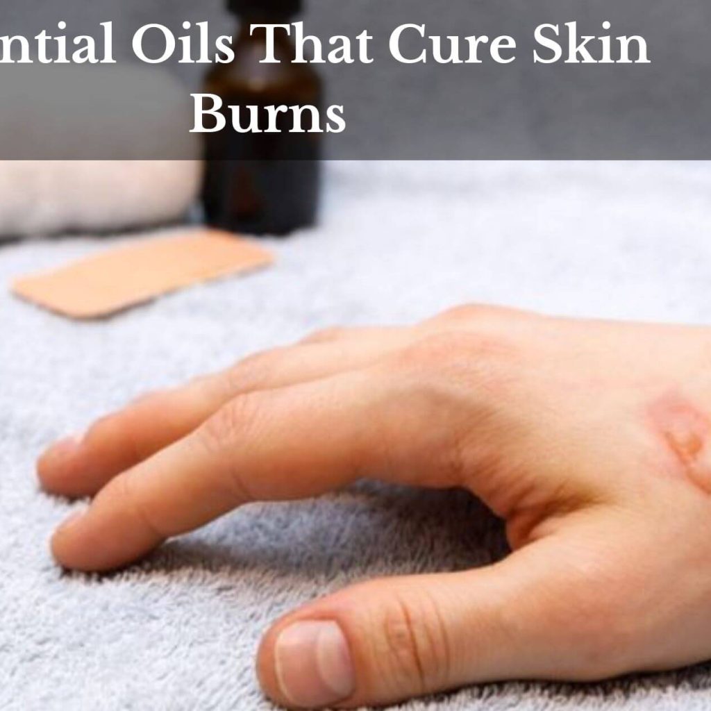 Essential Oils That Cure Skin Burns