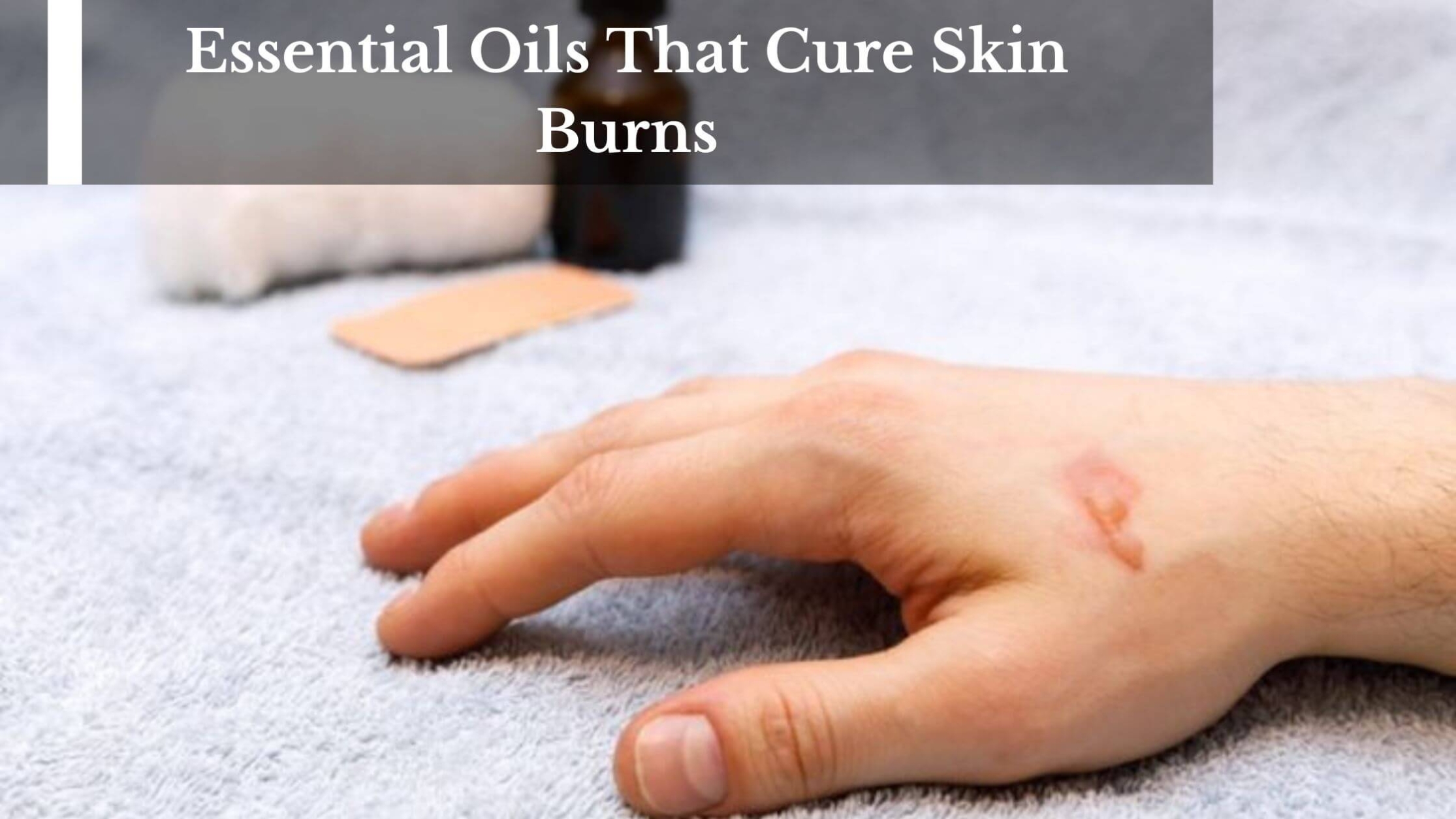 Essential Oils That Cure Skin Burns