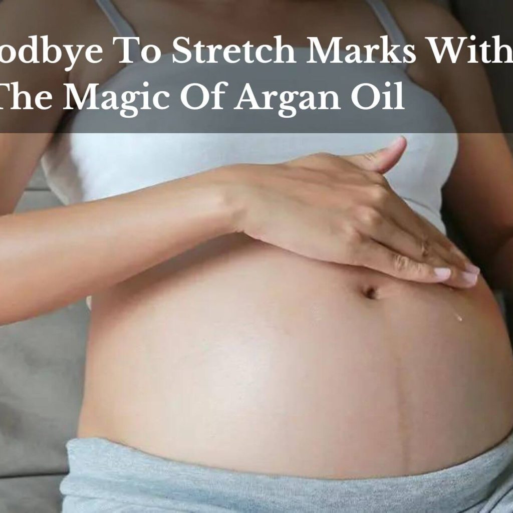 Say Goodbye To Stretch Marks With The Magic Of Argan Oil