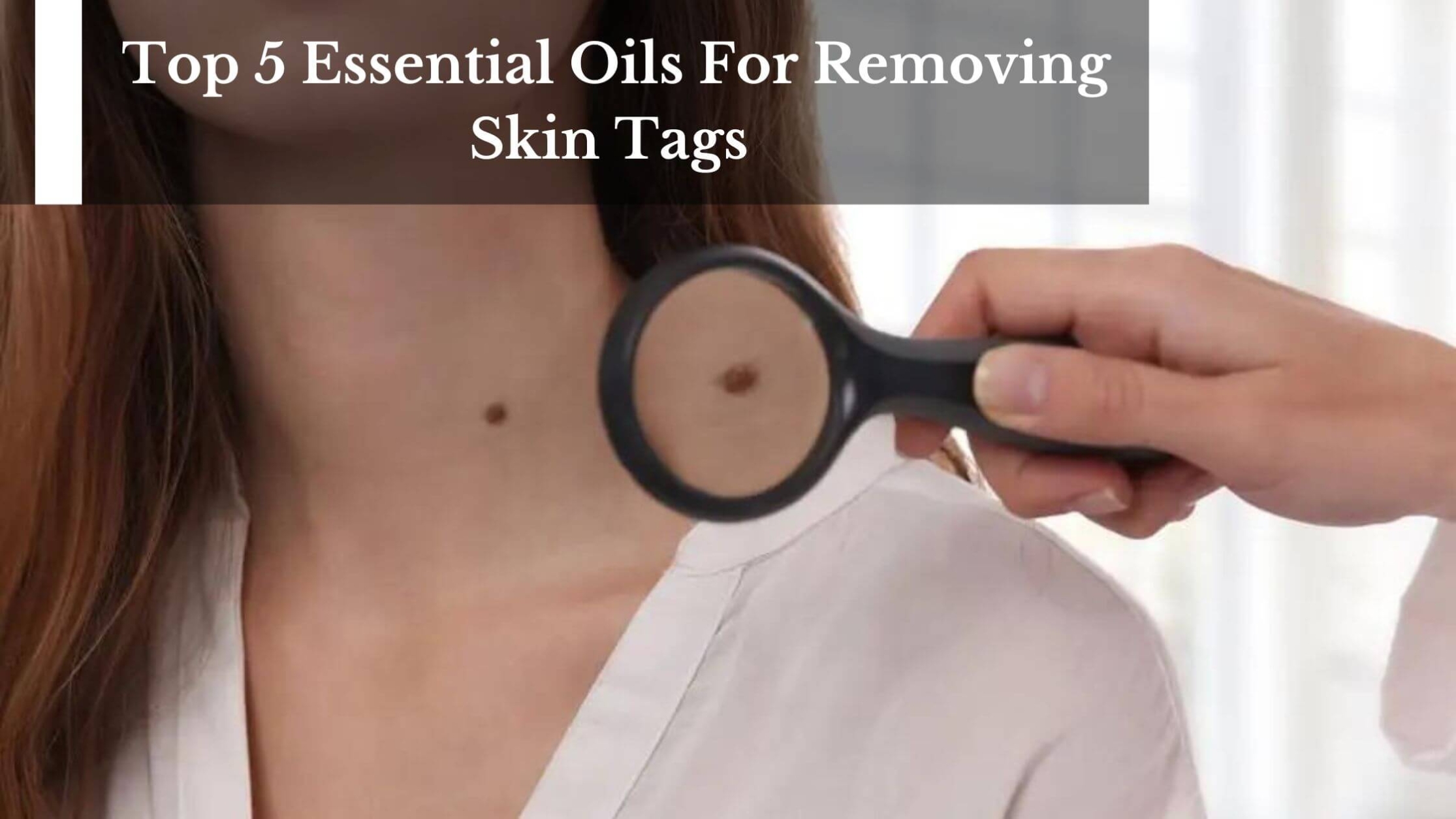Essential Oil To Remove Skin Tag Top 5 Essential Oils For Removing Skin Tags