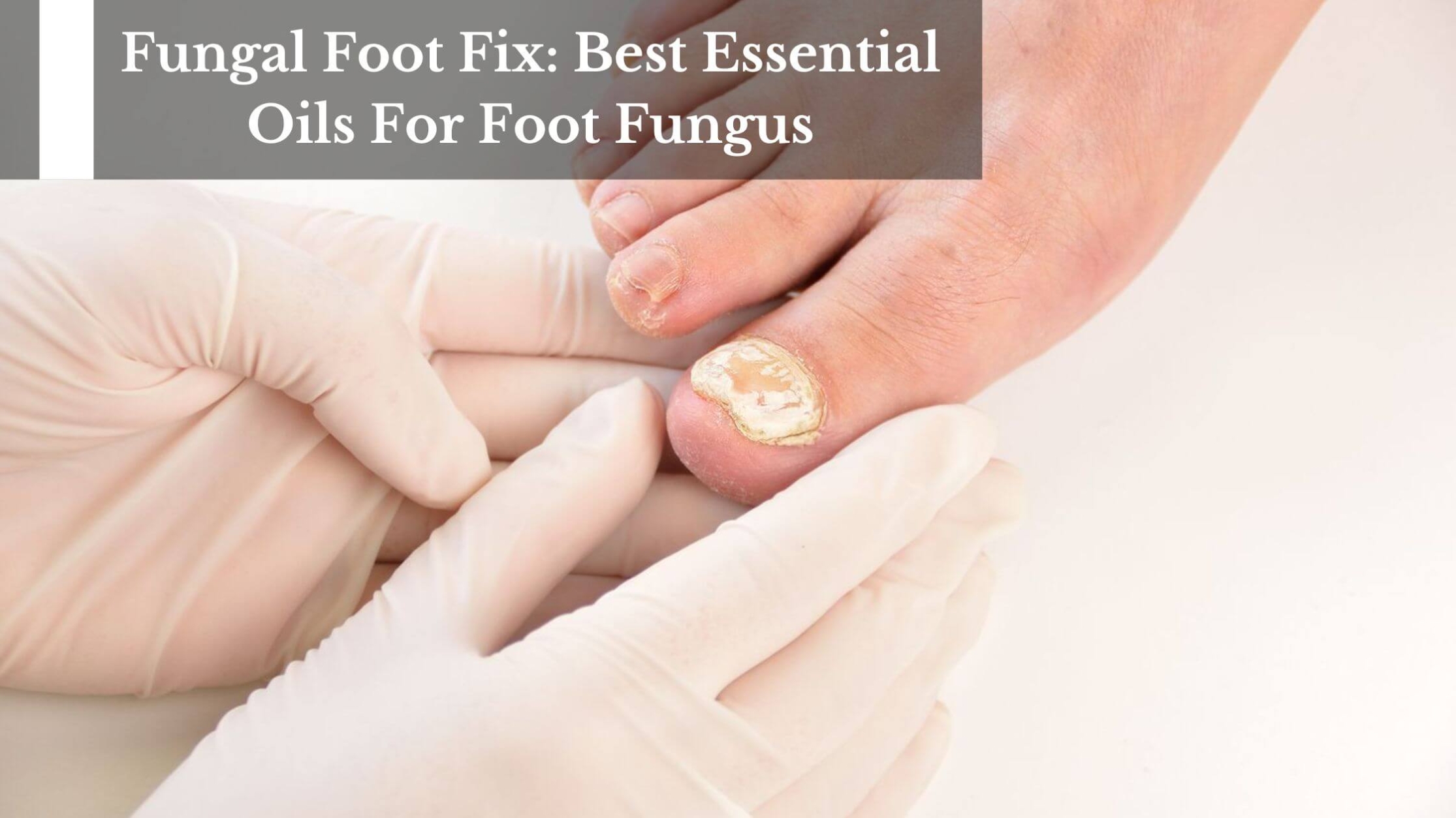 fungal-foot-fix-best-essential-oils-for-foot-fungus