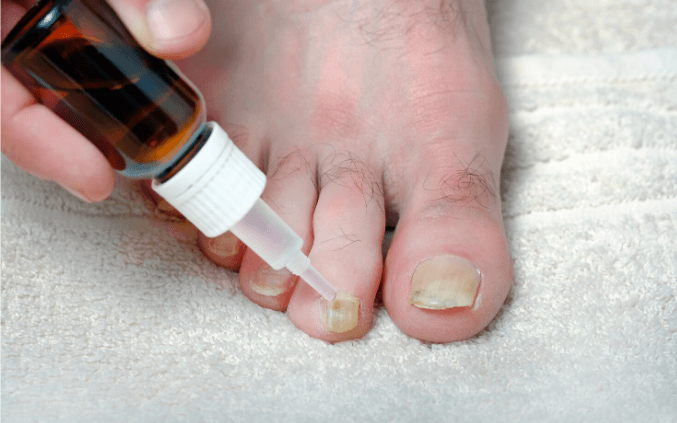 How To Use Essential Oils For Foot Fungus?
