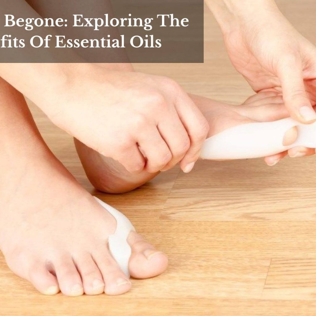 Bunions Begone: Exploring The Benefits Of Essential Oils