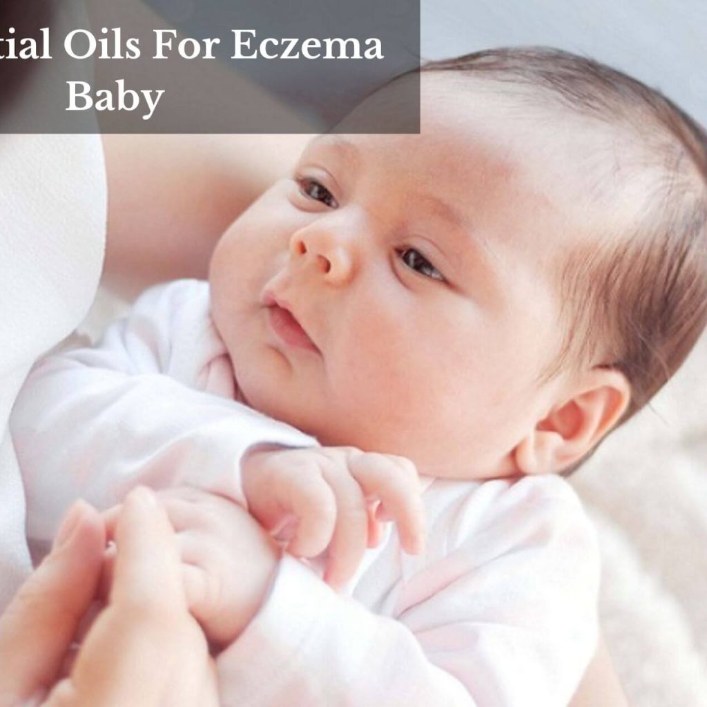 4 Essential Oils For Eczema Baby