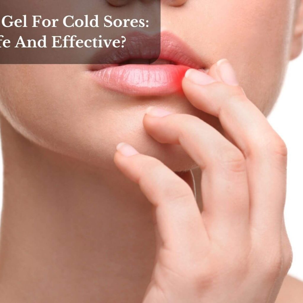 Aloe Vera Gel For Cold Sores: Is It Safe And Effective?