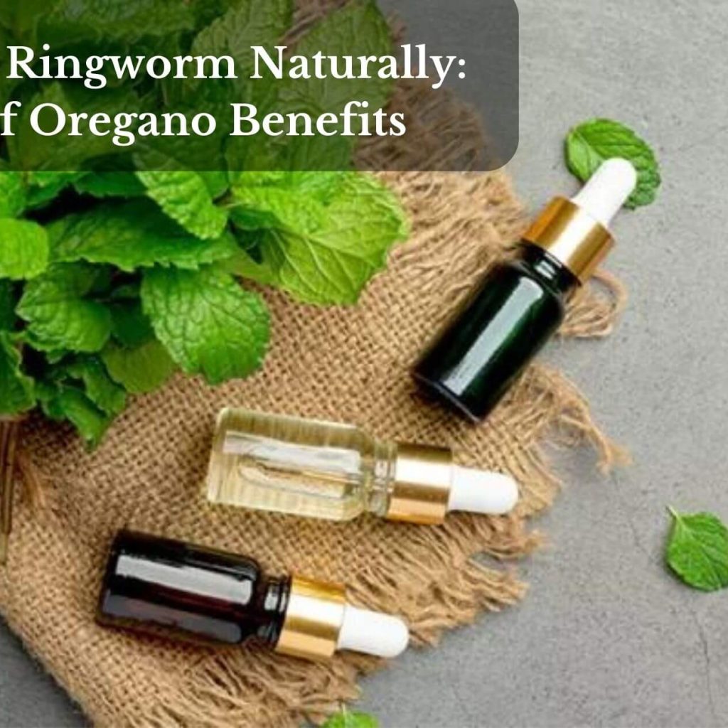 Combat Ringworm Naturally: Oil Of Oregano Benefits