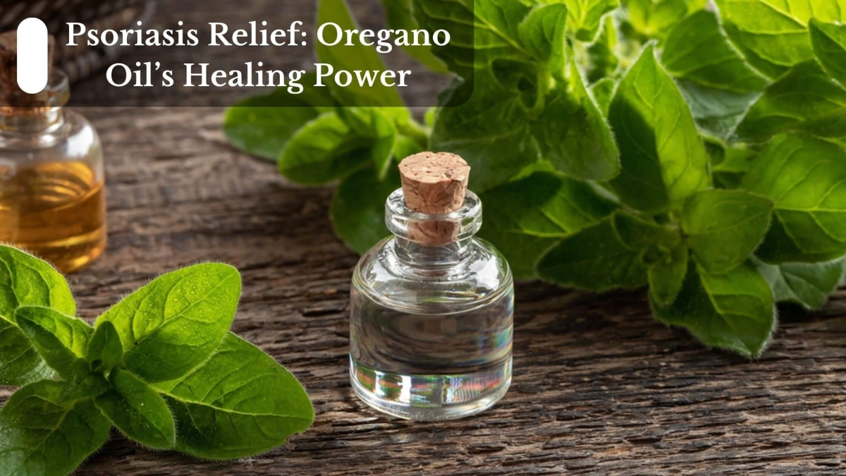 Psoriasis-Relief-Oregano-Oils-Healing-Power-1