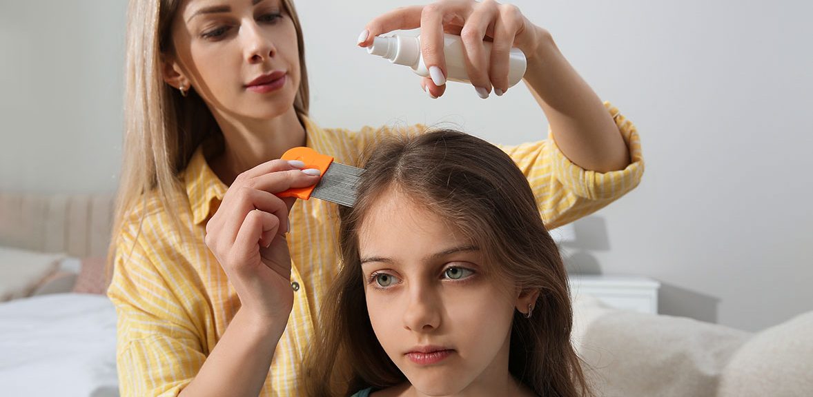 How To Use Rosemary Essential Oil For Lice Prevention?