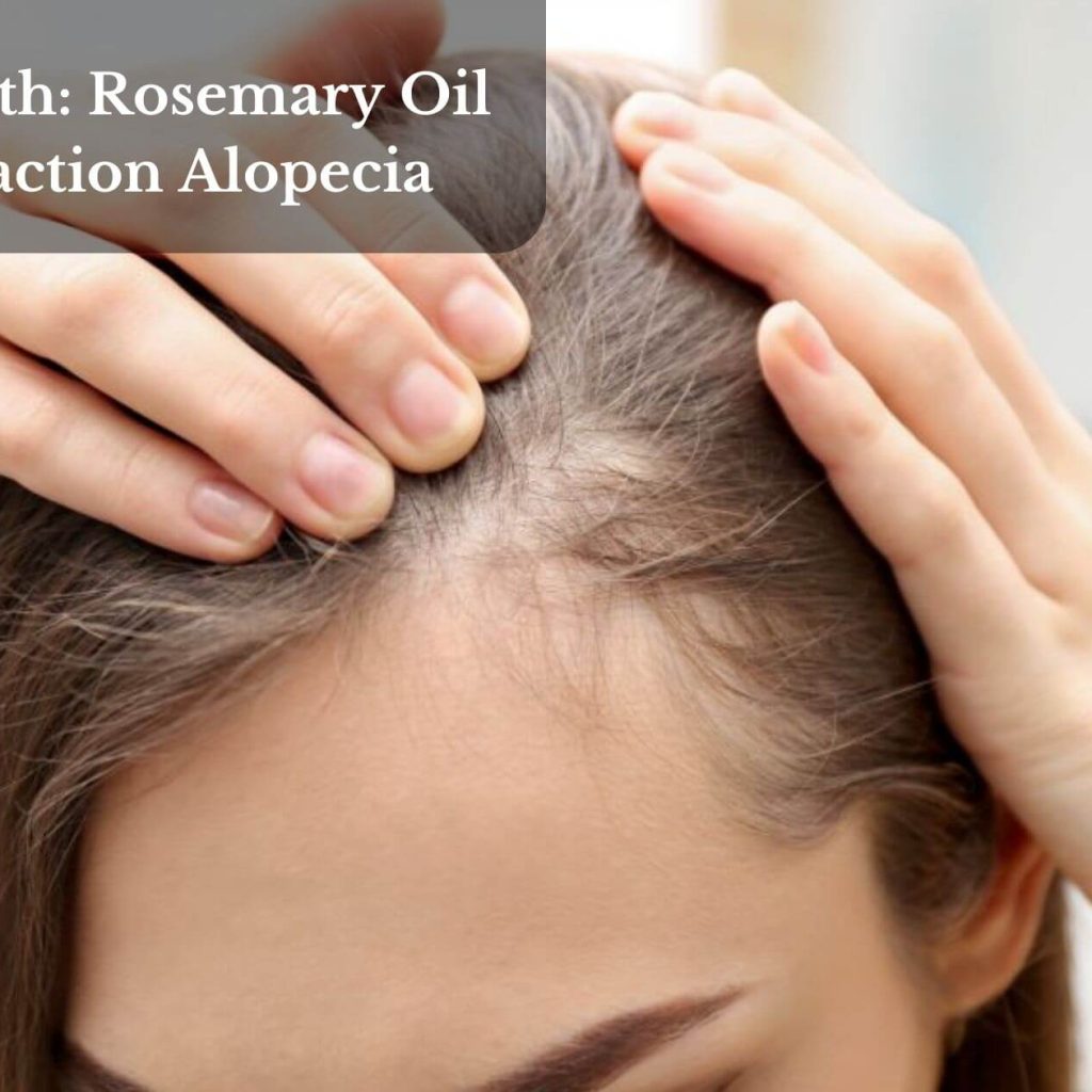Hair Health: Rosemary Oil And Traction Alopecia