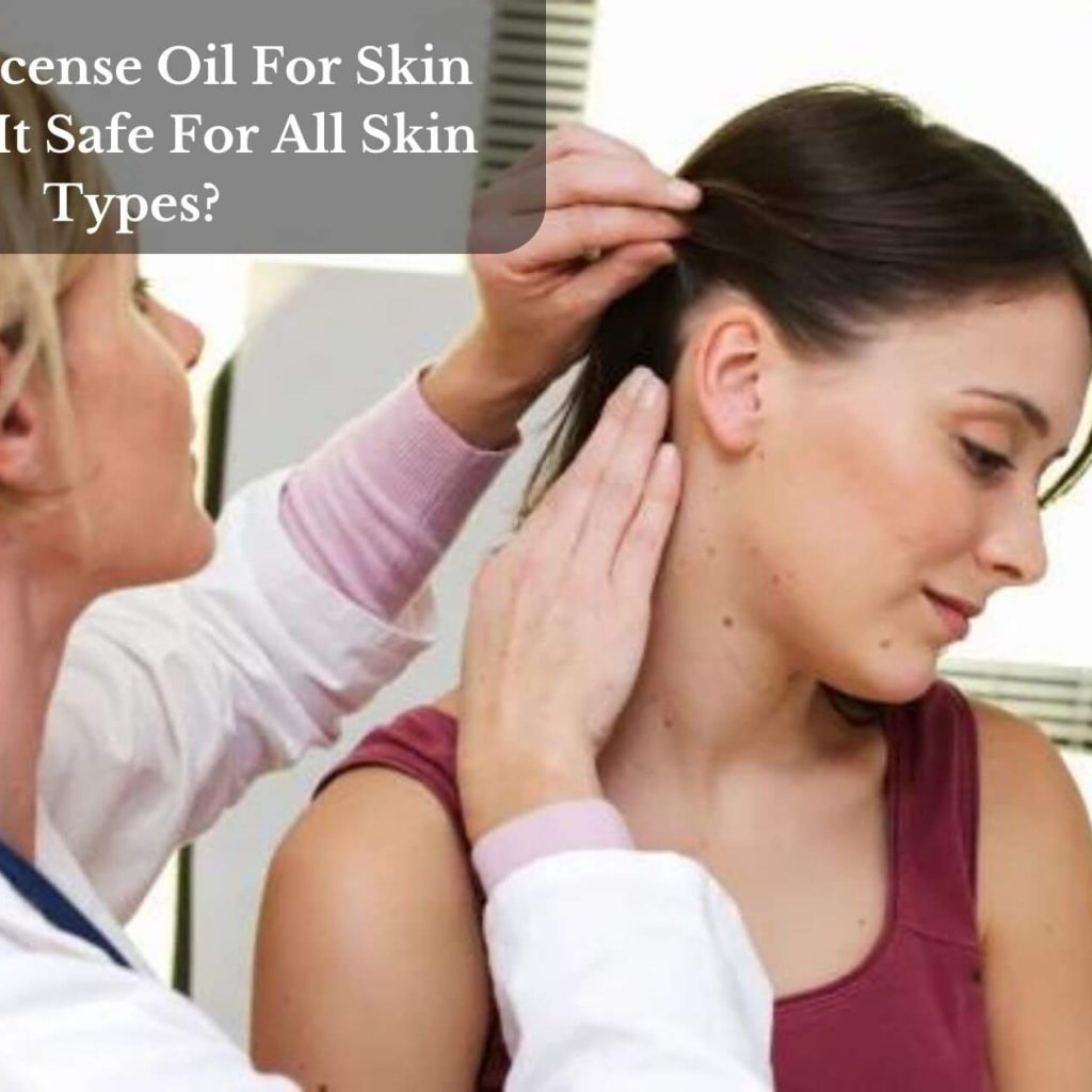 Frankincense Oil For Skin Tags: Is It Safe For All Skin Types?