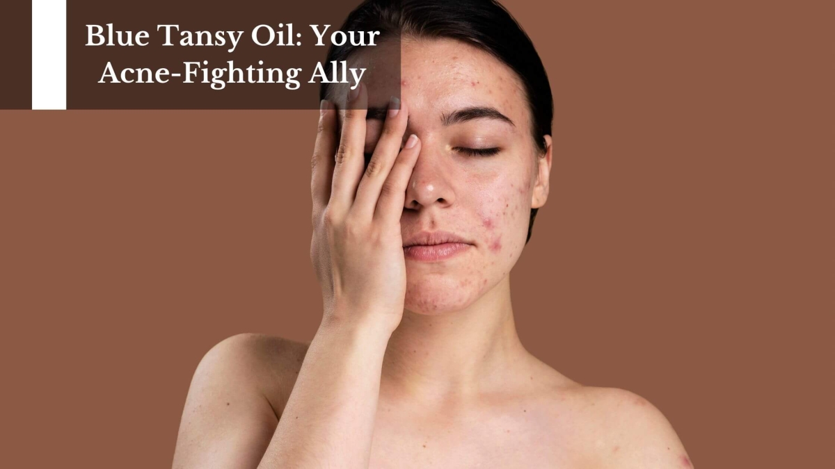Blue-Tansy-Oil-Your-Acne-Fighting-Ally-1