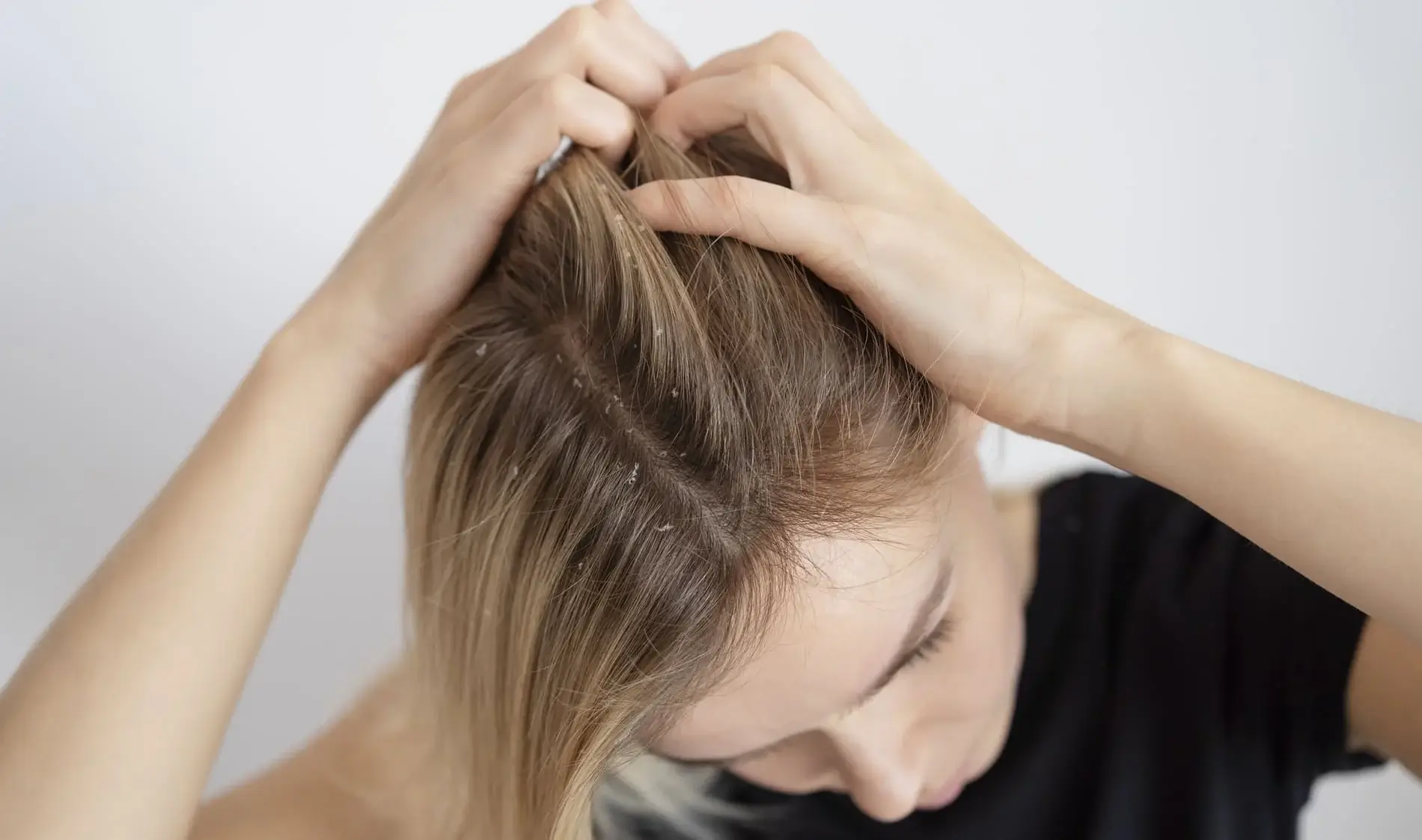 The Power Of Castor Oil: Transform Your Nails With Natural Growth