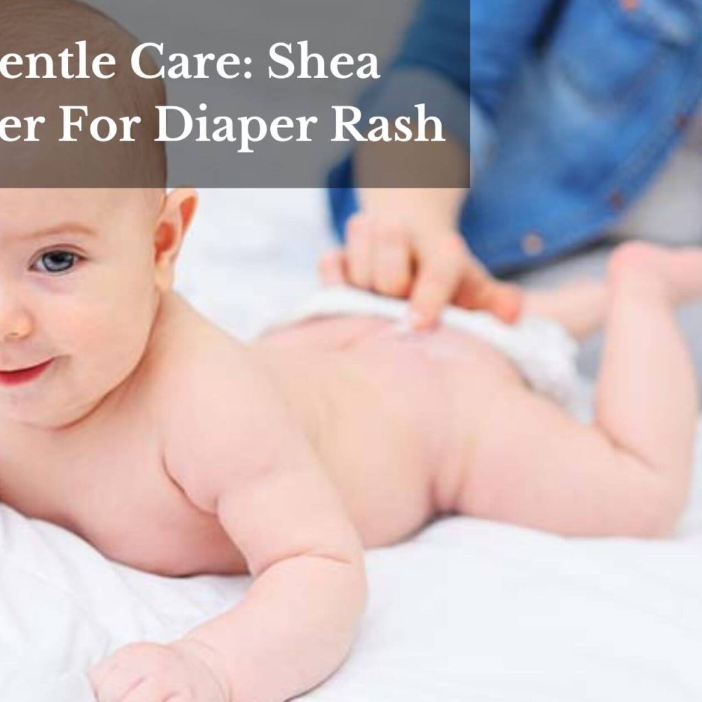 Gentle Care: Shea Butter For Diaper Rash