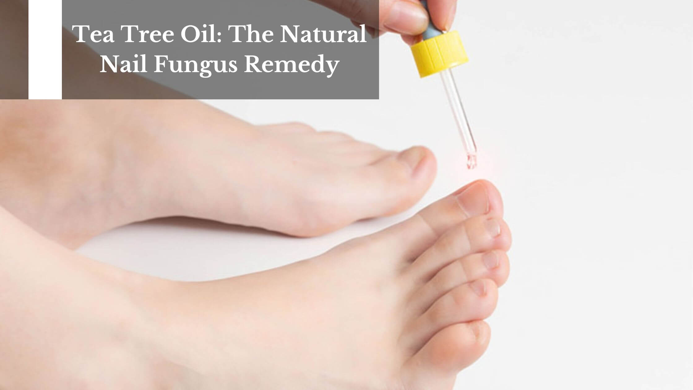 10 Home Remedies for Foot Fungus: Athlete's Foot, Toenail Fungus - Parade