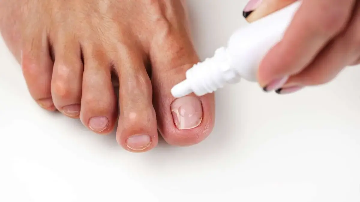 How To Use Tea Tree Oil For Nail Fungus?