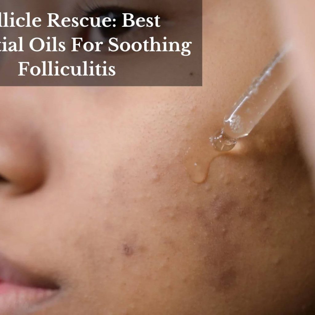 Follicle Rescue: Best Essential Oils For Soothing Folliculitis