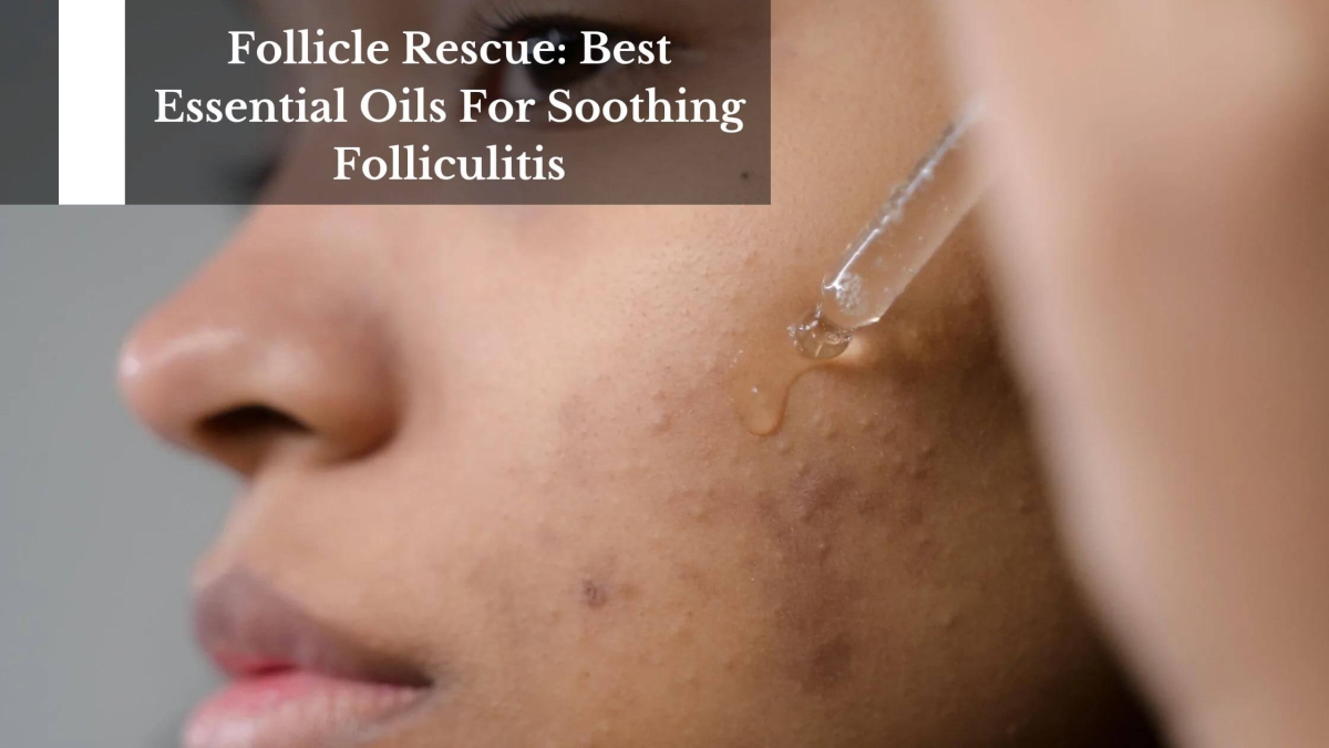 Follicle-Rescue-Best-Essential-Oils-For-Soothing-Folliculitis-1
