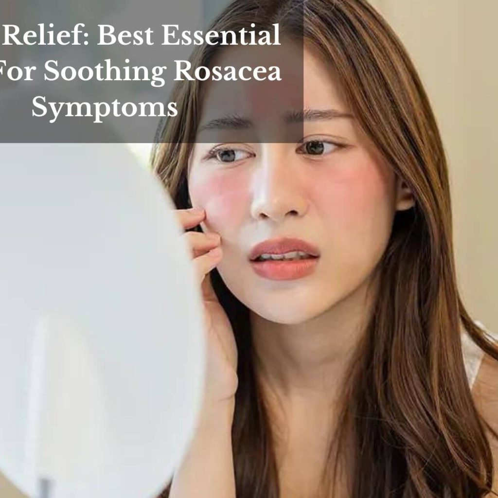 Rosy Relief: Best Essential Oils For Soothing Rosacea Symptoms