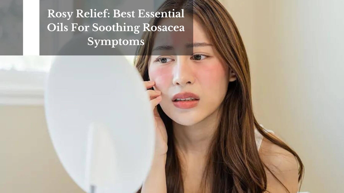 Rosy-Relief-Best-Essential-Oils-For-Soothing-Rosacea-Symptoms-1