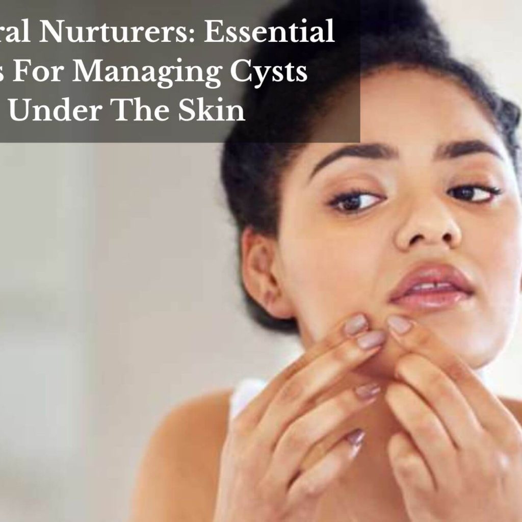 Natural Nurturers: Essential Oils For Managing Cysts Under The Skin