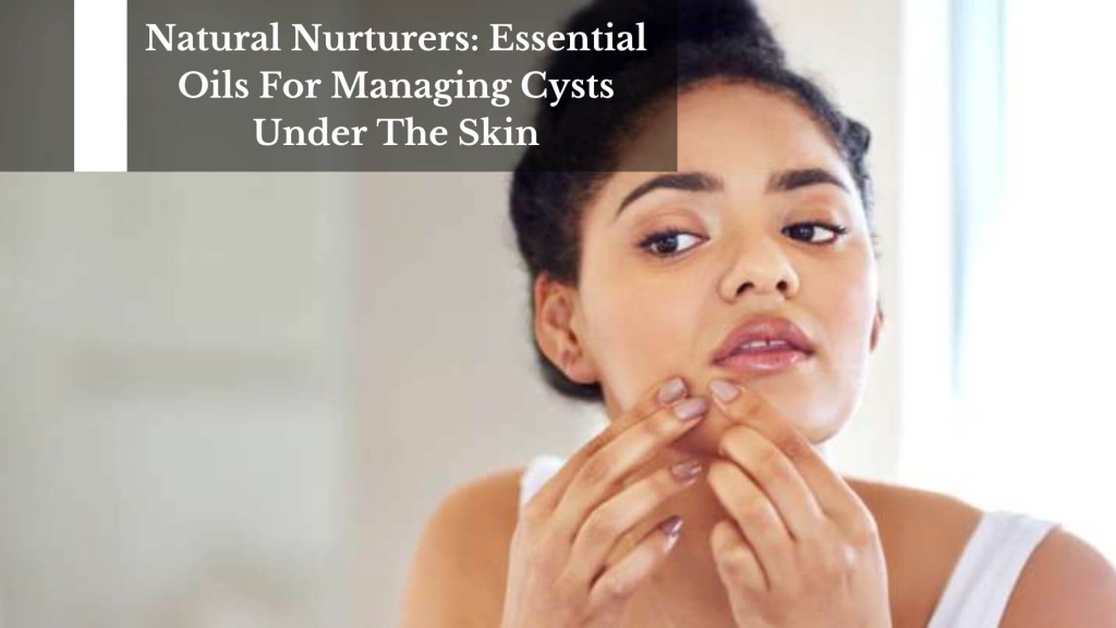 Natural Nurturers Essential Oils For Managing Cysts Under The Skin