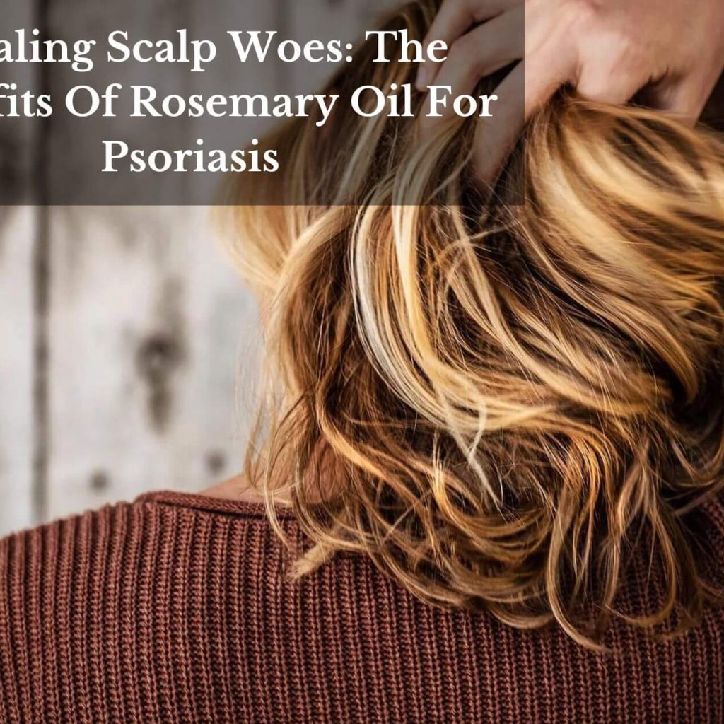 Healing Scalp Woes: The Benefits Of Rosemary Oil For Psoriasis