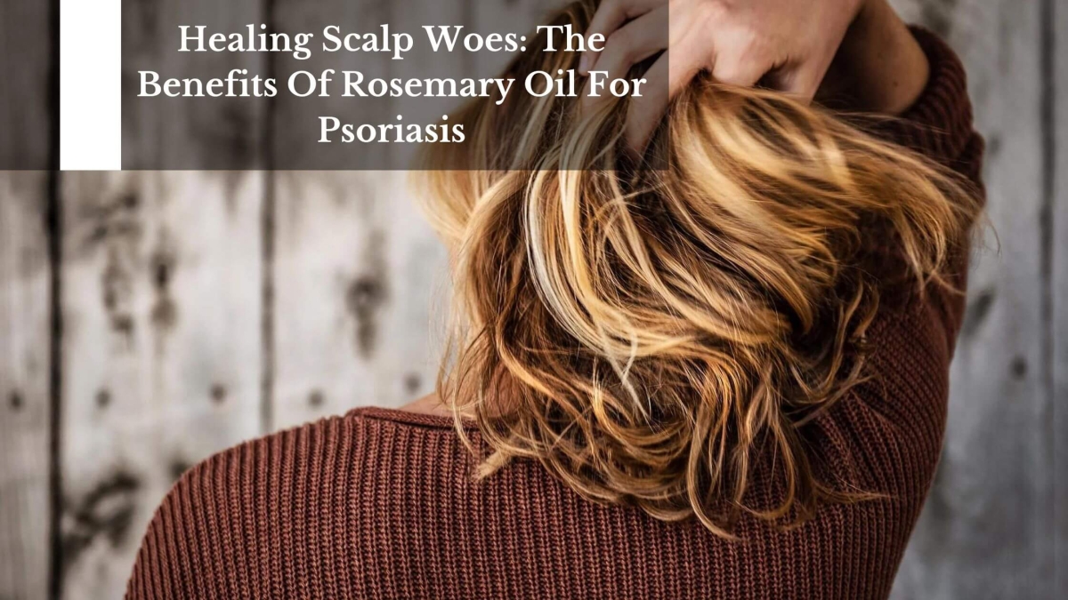 Healing-Scalp-Woes-The-Benefits-Of-Rosemary-Oil-For-Psoriasis-1