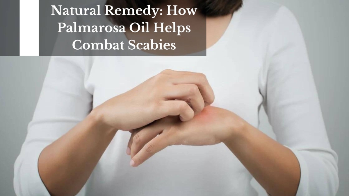 Natural-Remedy-How-Palmarosa-Oil-Helps-Combat-Scabies-1