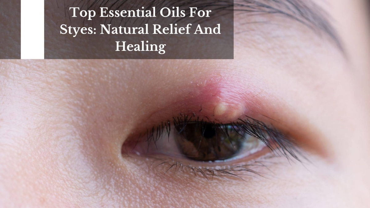 Top-Essential-Oils-For-Styes-Natural-Relief-And-Healing-1