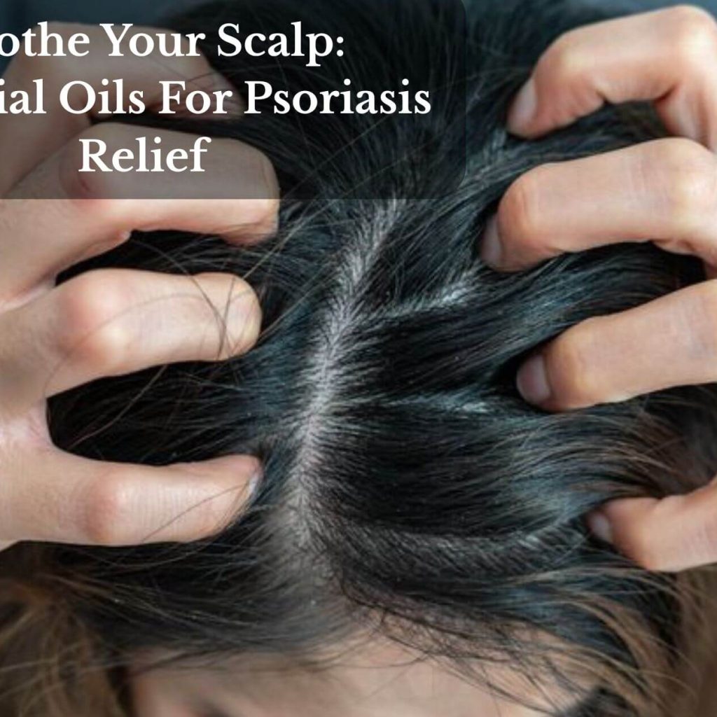 Soothe Your Scalp: Essential Oils For Psoriasis Relief