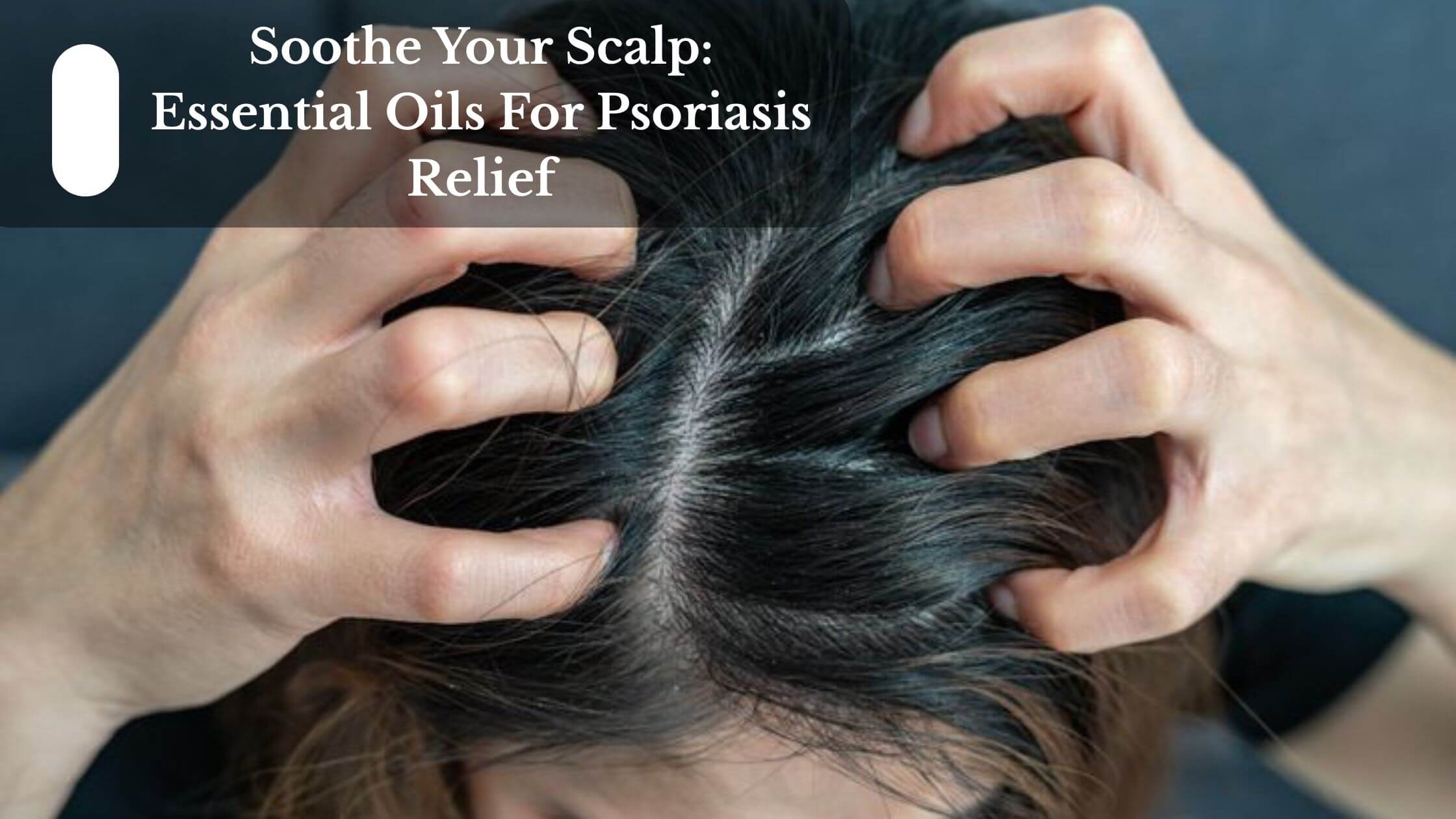 Soothe Your Scalp: Essential Oils For Psoriasis Relief