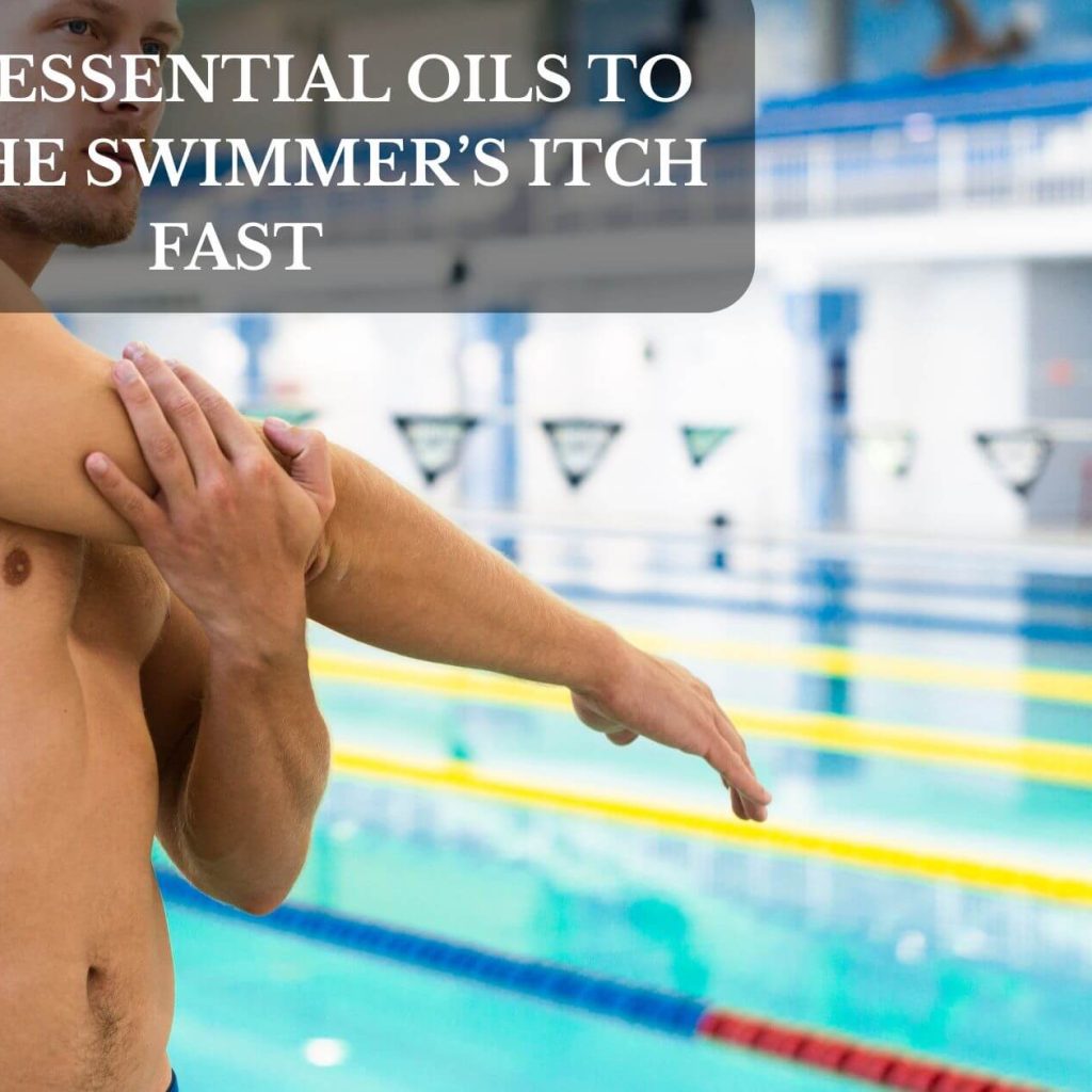 Top 5 Essential Oils To Soothe Swimmer’s Itch Fast