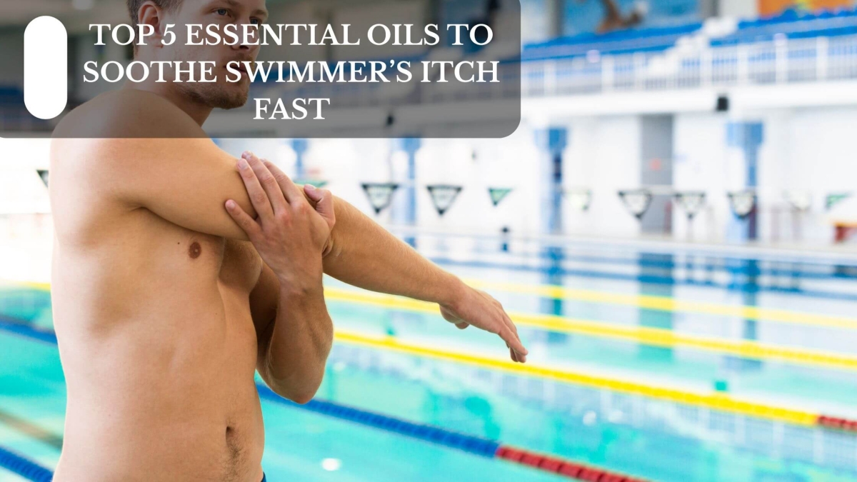 TOP 5 ESSENTIAL OILS TO SOOTHE SWIMMER’S ITCH FAST (1)