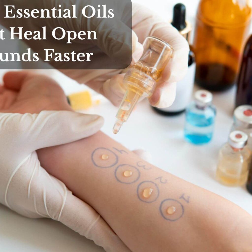 Top 11 Essential Oils That Heal Open Wounds Faster